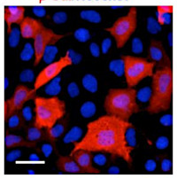 GAL | Beta galactosidase in the group Antibodies Human Research / Tag Antibodies / GST at Agrisera AB (Antibodies for research) (AS20 4515)